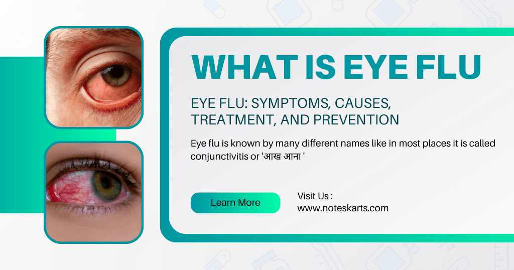 Eye Flu Symptoms, Causes, Treatment, And Prevention Noteskarts