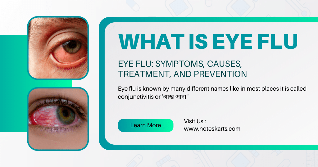 You are currently viewing Eye Flu: Symptoms, Causes, Treatment, and Prevention